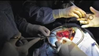 UP doctors remove 5.5 kg tumour from woman's kidney