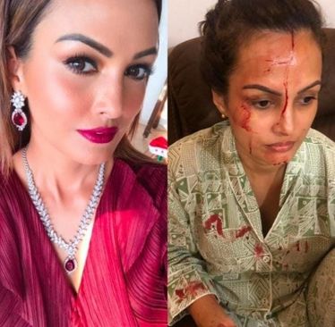 Nisha Rawal accuses Karan Mehra of having an affair, beating her