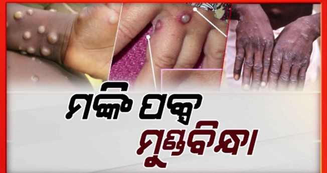 Monkey Pox in India:  The central government has issued guidelines to all states