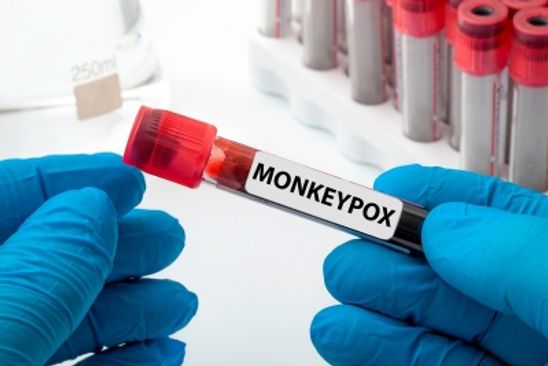 Monkeypox reported for 3rd time in a minor in US