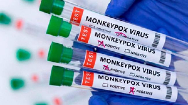 Centre Confirms Presence Of Mpox Virus In Isolated Patient, No Widespread Risk