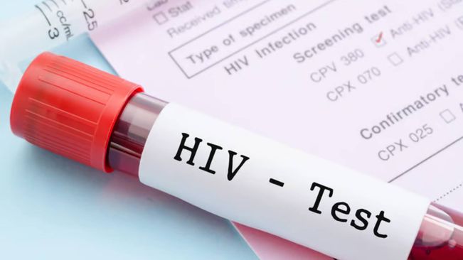 AIIMS Bhubaneswar Tests 8518 Individuals, 31 Test HIV Positive In Last Three Months