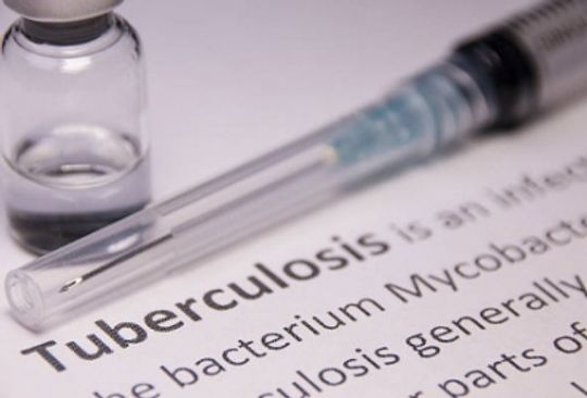 Body's response to different strains of TB could affect transmission