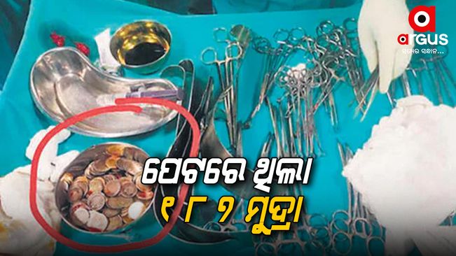 187 coins came out of the man's stomach.