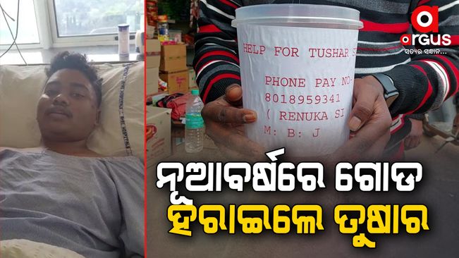 A young boy lost his leg in an accident in Baripada