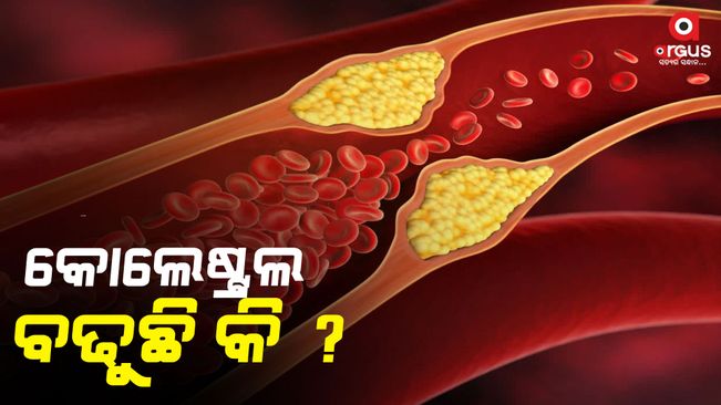 high cholesterol very dangerous for heart reduce bad cholesterol