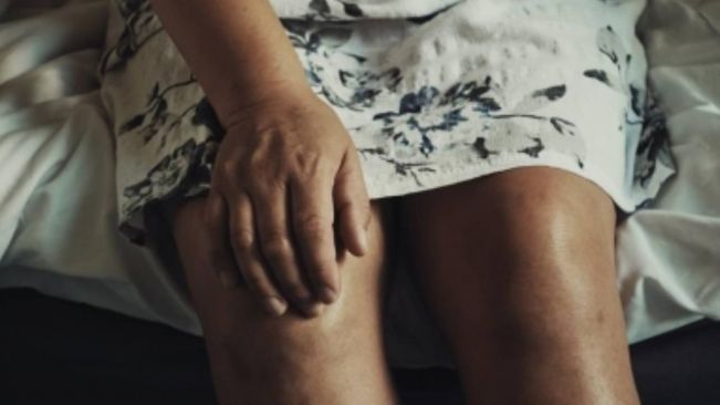 More than one in six arthritis patients are women, say doctors