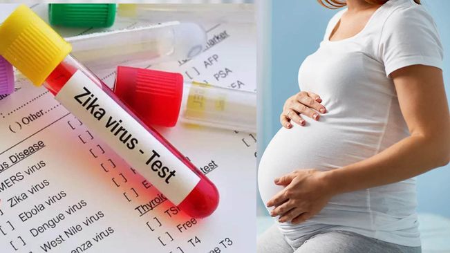 Here’s How Zika Virus Can Impact Pregnancy, Cause Newborn Complications