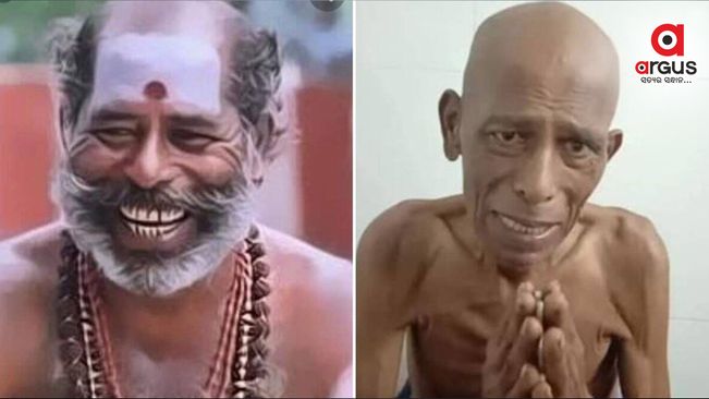 କ୍ୟାନସର ସହ ଲଢୁଛନ୍ତି ଏହି ଅଭିନେତା